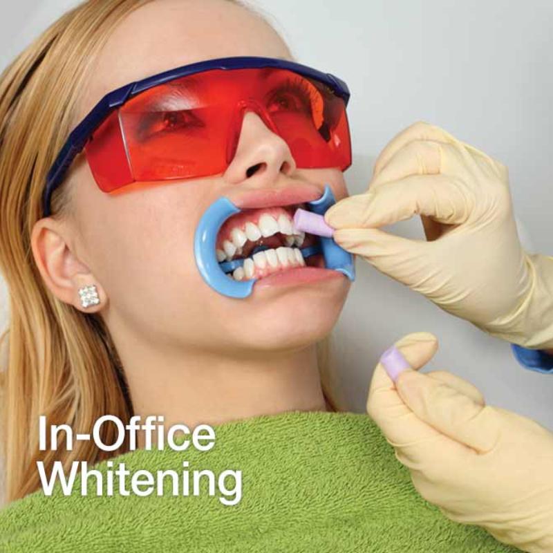 Teeth Whitening